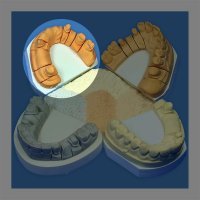 Гіпс Hinriplast N, 5 кг, абрикосовий, IV клас