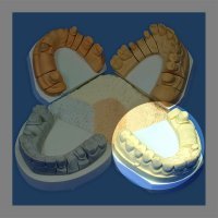 Гіпс Hinriplast N, 5 кг, слонова кістка, IV клас