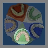 Гіпс Base Stone FL, 2.5 кг, зелений, цокольний, IV клас