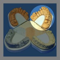 Гіпс Hinriplast N, 25 кг, золотисто-коричневий, IV клас, картон