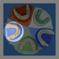 Гіпс Base Stone FL, 2.5 кг, синій, цокольний, IV клас
