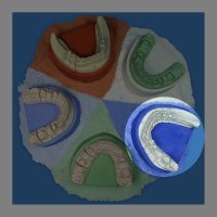 Гіпс Base Stone FL, 2.5 кг, темно-синій, цокольний IV клас