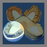 Гіпс Hinriplast N, 2.5 кг, перлинно-сірий, IV клас